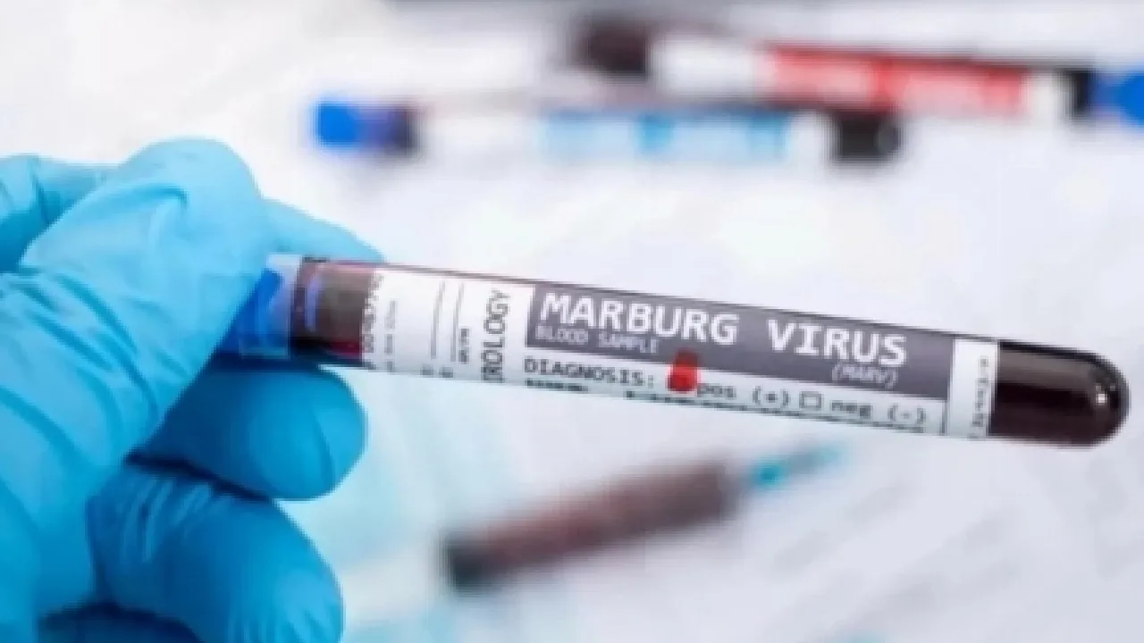 எத்தியோப்பியாவைத் தாக்கும் கொடிய வைரஸ் – சவுதி அரேபியா குடிமக்களை எச்சரிக்கிறது!