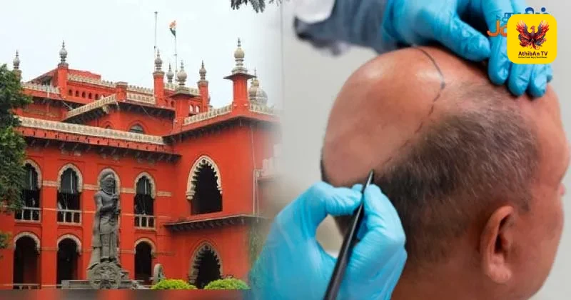 12-ஆம் வகுப்பு படித்தவர்களால் முடிமாற்று சிகிச்சையா? ஜாமின் மனுவைத் தள்ளுபடி செய்து நீதிமன்றம் அதிரடி!